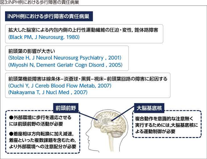 図3:iNPH例における歩行障害の責任病巣