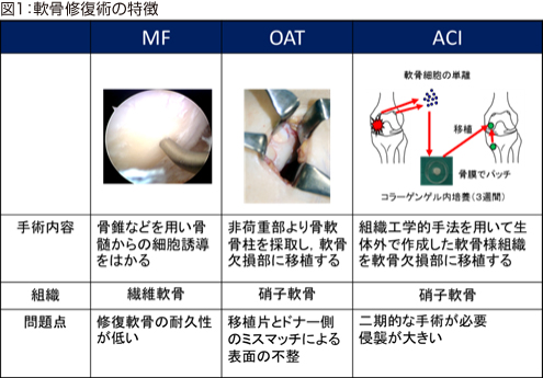 図1:軟骨修復術の特徴