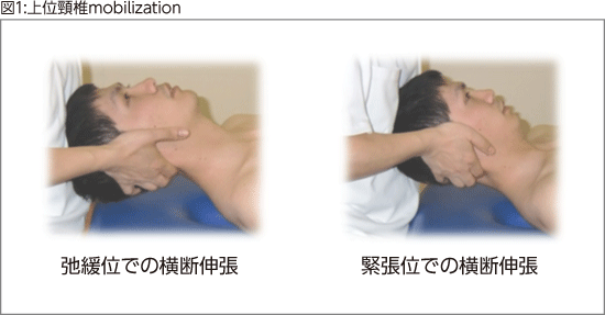 図1:上位頸椎mobilization