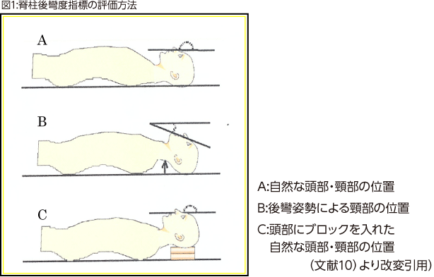 図1:脊柱後彎度指標の評価方法